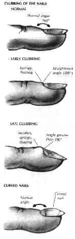 Orthodoc's wisdom on finger nails is illustrated in Bates' Guide to Physical